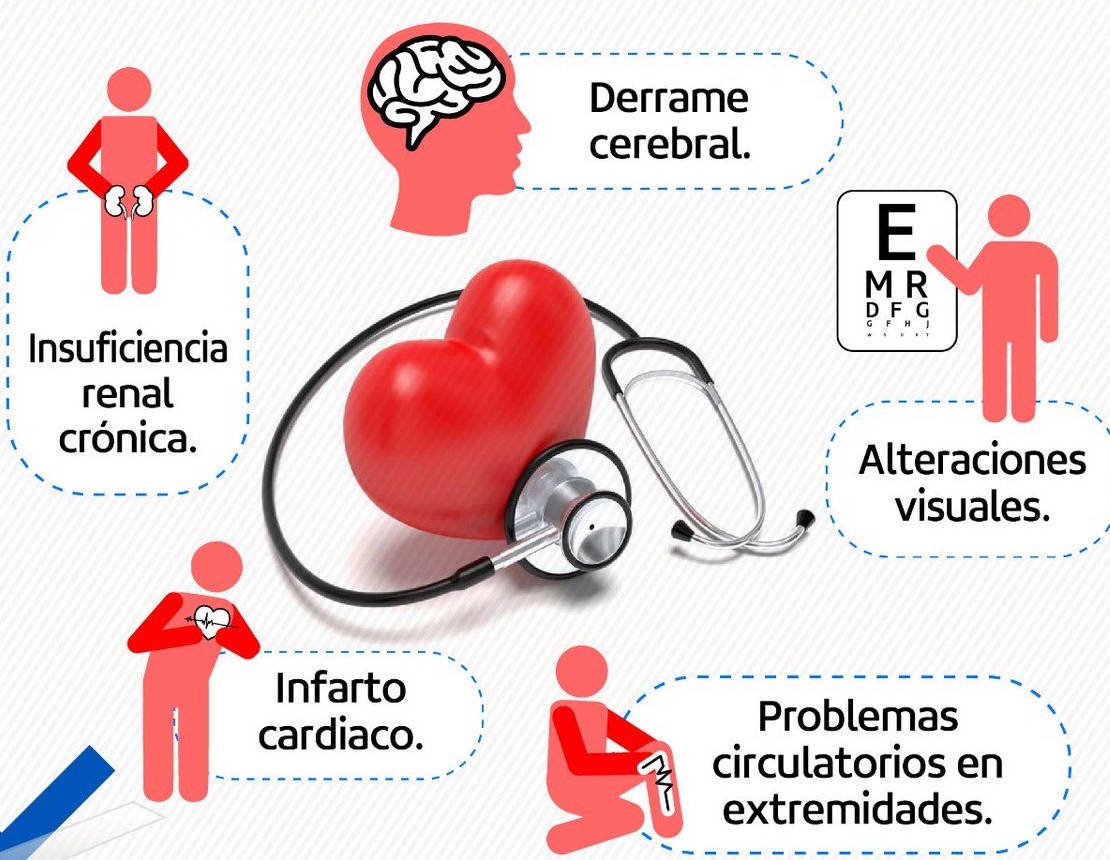 imagen de las presion